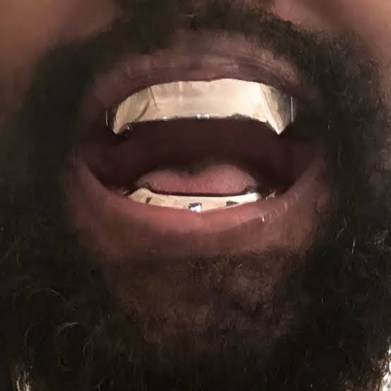 BULLY GRILLZ